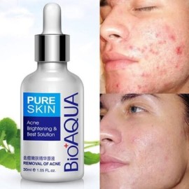 Serum antiacne BIOAQUA